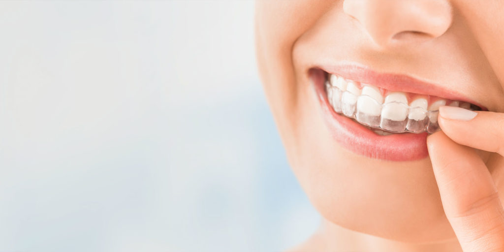 dental patient wearing invisalign