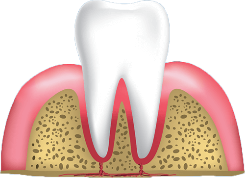 healthy gums graphic