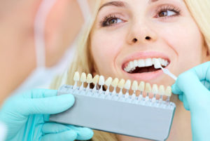 Dental Patient Getting Dental Veneers Applied
