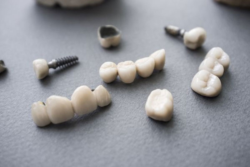 Dental Crowns And Bridges On A Table