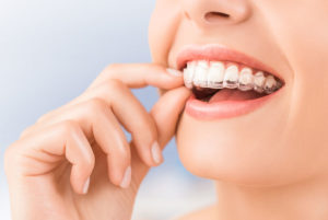 A dental patient removing her invisalign aligner