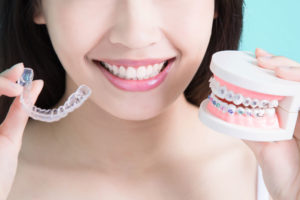 a dental patient holding models for clear aligners and invisalign