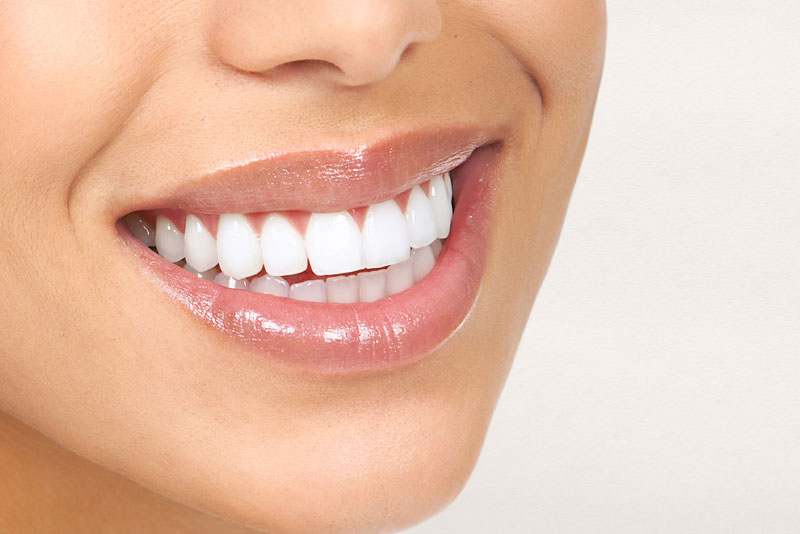 a patient smiling after receiving dental veneers.