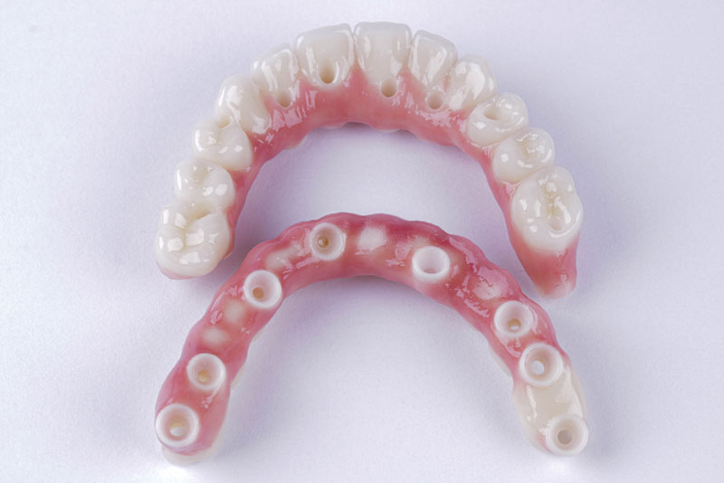 zirconia bridges of teeth, with dental implants in them, so they can improve the look and function of a patients smile with a zirconia fixed bridge.