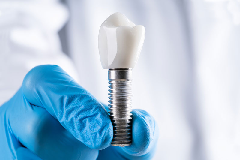 a dental implant dental holding a single implant with a post and dnetal crown.