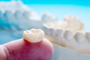 a dentist’s finger holding a dental crown with a dental bridge model behind.