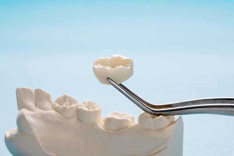 dental crown 3D image.