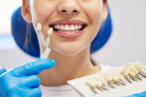 a doctor doing color matching to make a patient a set of veneers